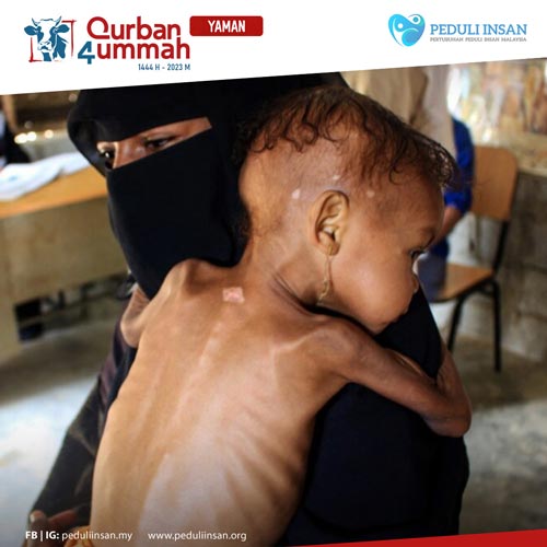 Qurban4Ummah - Pertubuhan Peduli Insan Malaysia